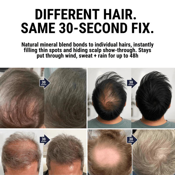 DENSIQ Pro™ - Instant Hair Density Filler