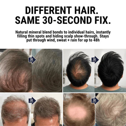 DENSIQ Pro™ - Instant Hair Density Filler